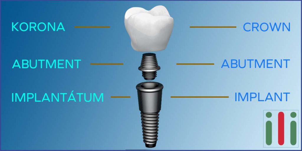 Kétfázisú Implantátum, Amit Tudni Kell Róla (1. rész)
