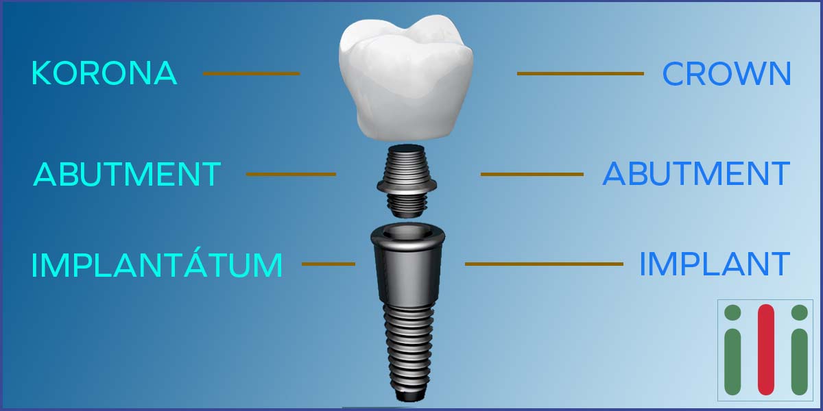 Kétfázisú Implantátum, Amit Tudni Kell Róla (1. rész)