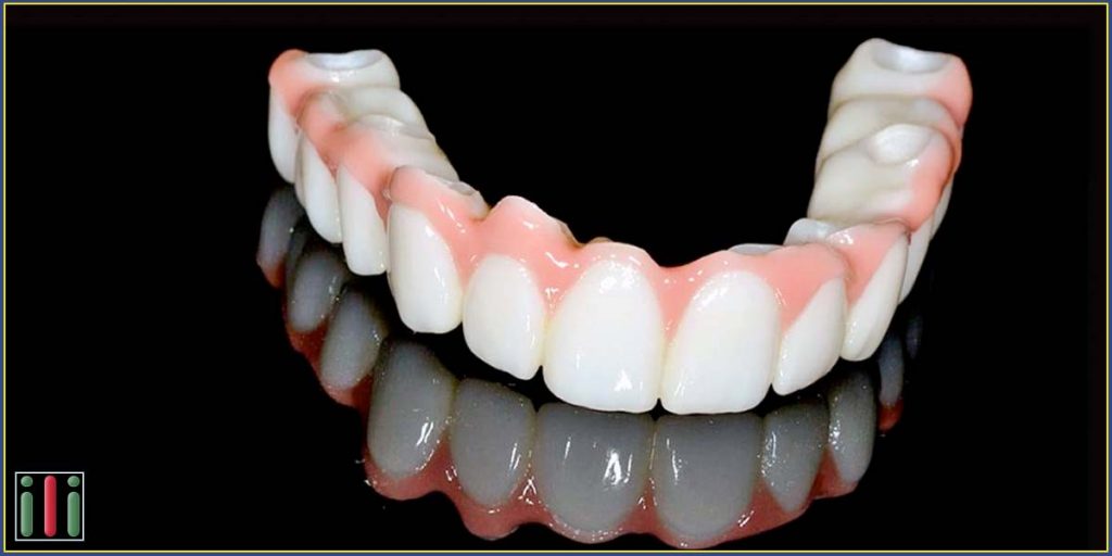 Dental implant-based dentures - is it suitable for seniors?