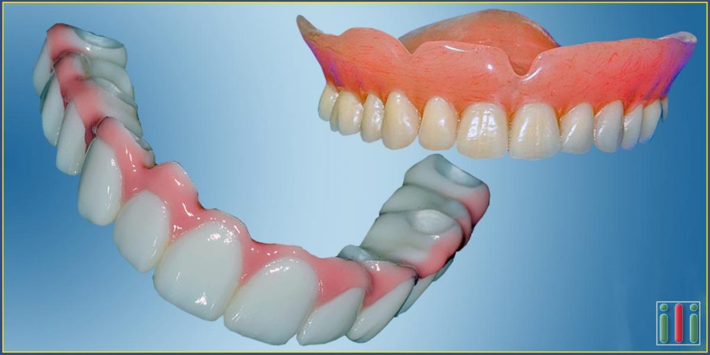Mouth rehabilitation with a one-phase dental implant