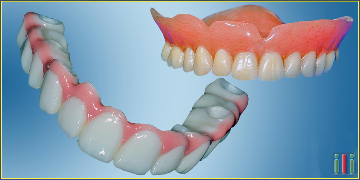 Mouth rehabilitation with a one-phase dental implant