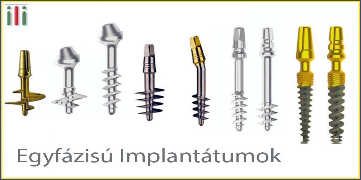 Fogászati implantátumok - Kinek melyik alkalmas