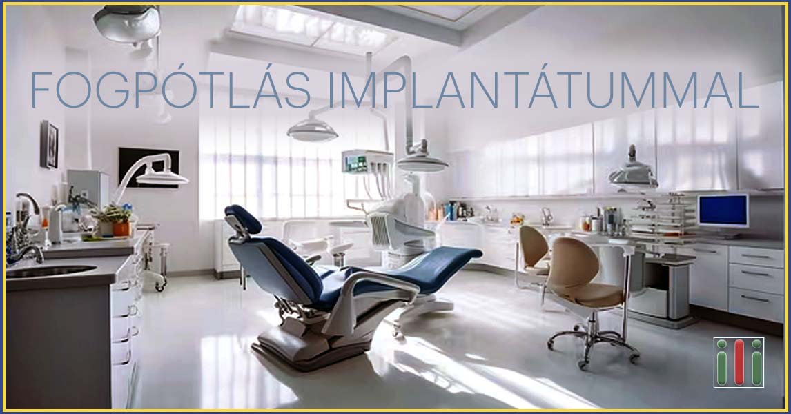 Fogpótlás implantátummal - A ma ismert legjobb megoldás