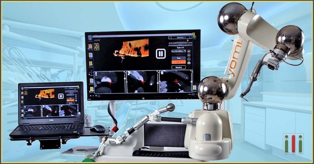 Robotizált fogászati implantátum beültetés – 21. századi megoldás